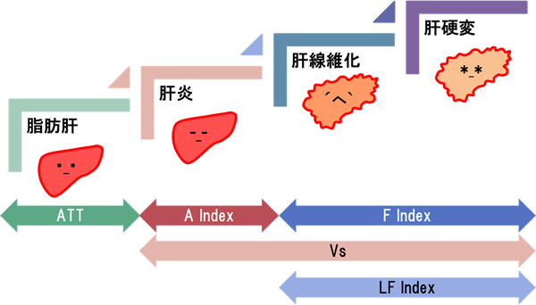 脂肪肝の進行